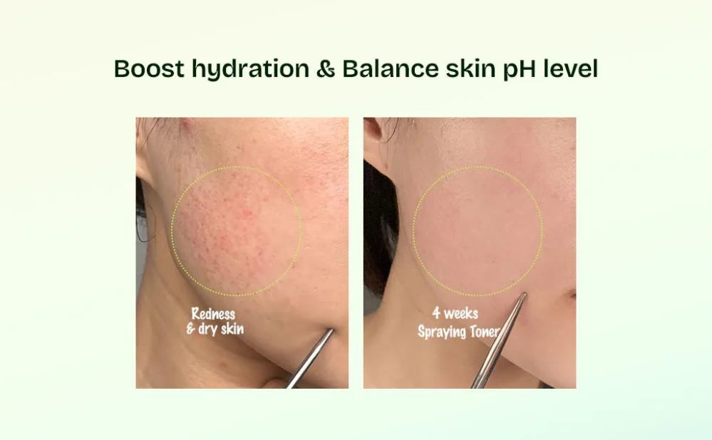 Orien – Tónico Mugwort Soothe In Toner