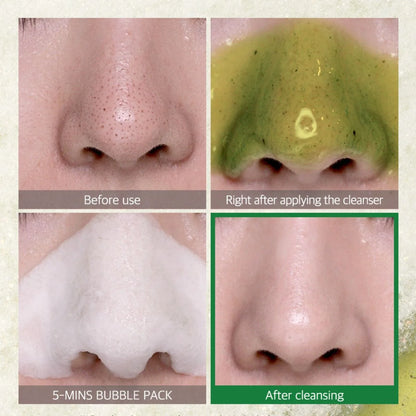 SOME BY MI – Limpiador Facial de Burbujas Bye Bye Blackhead Green Tea Tox
